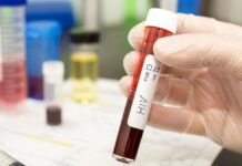 Hingga Maret 2025, Kemenkes temukan 356.638 orang dari 564 ribu ODHIV